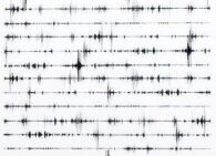Strudel: Tarayıcı Tabanlı Canlı Kodlama ve Fonksiyonel Müzik Tasarımı
