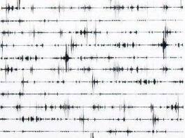 Strudel: Tarayıcı Tabanlı Canlı Kodlama ve Fonksiyonel Müzik Tasarımı