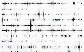 Strudel: Tarayıcı Tabanlı Canlı Kodlama ve Fonksiyonel Müzik Tasarımı