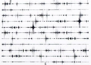 Strudel: Tarayıcı Tabanlı Canlı Kodlama ve Fonksiyonel Müzik Tasarımı